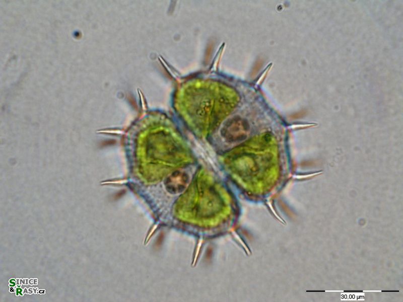 Xanthidium fasciculatum