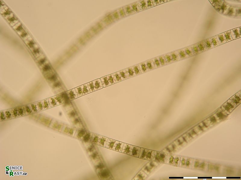 Zygnema