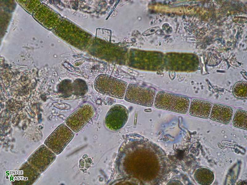 Zygogonium