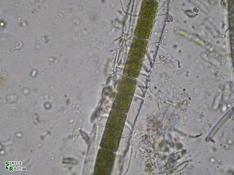 Zygogonium