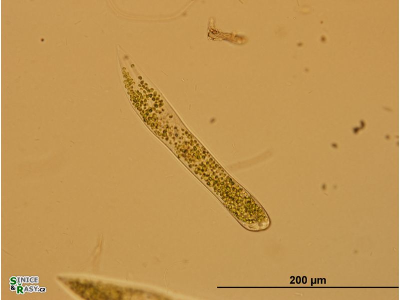Ophrydium sp.