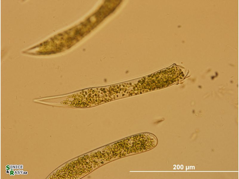 Ophrydium sp.