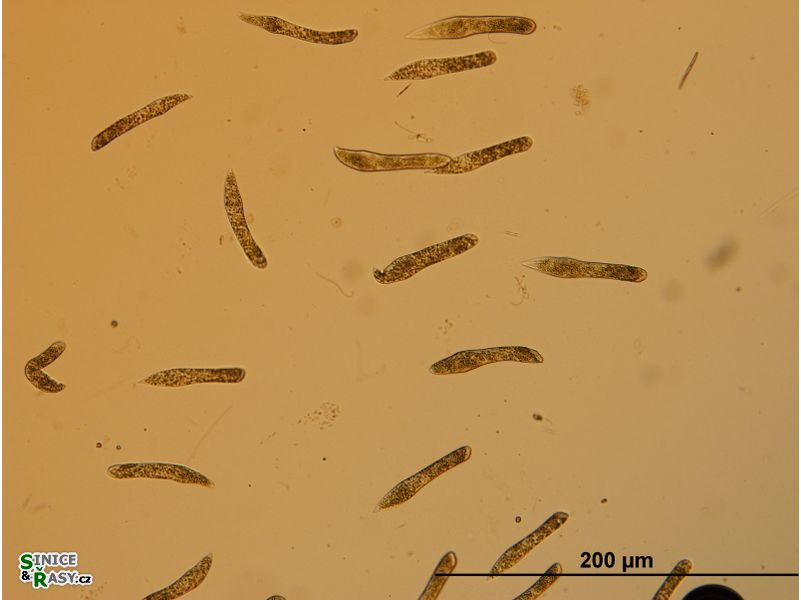 Ophrydium sp.