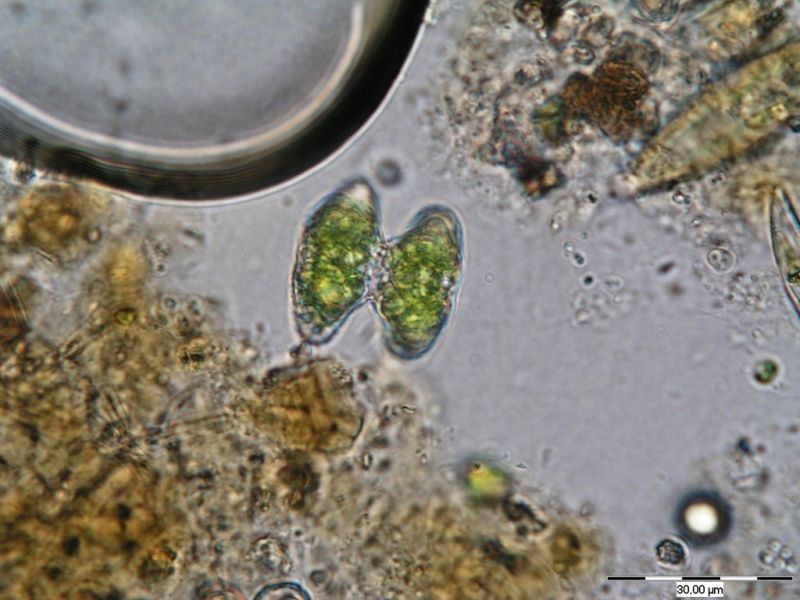Staurastrum striolatum