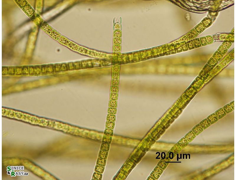 Microspora sp. 