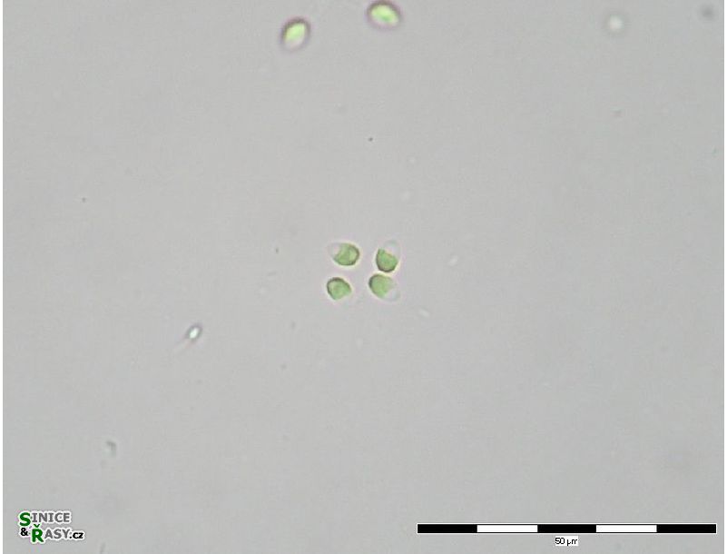 Mucidosphaerium sphagnale
