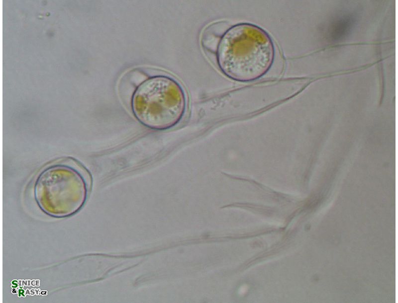 Dinobryon sertularia