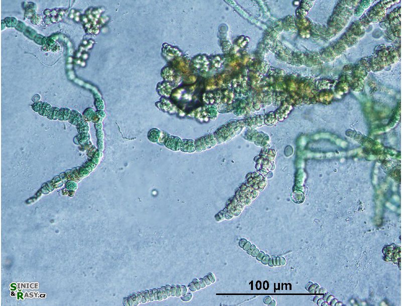 Westiellopsis prolifica