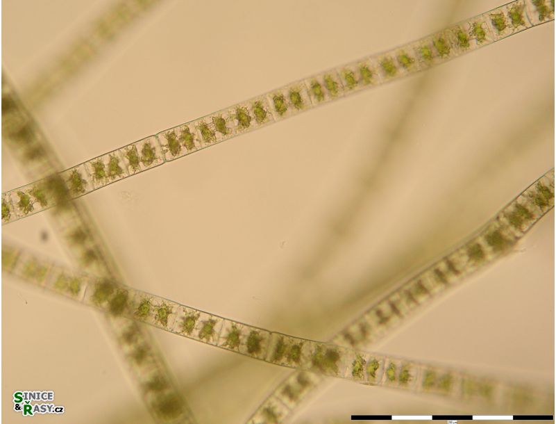 Zygnema