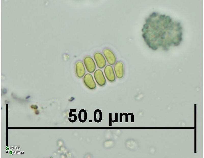 Scenedesmus obtusus var. disciformis 