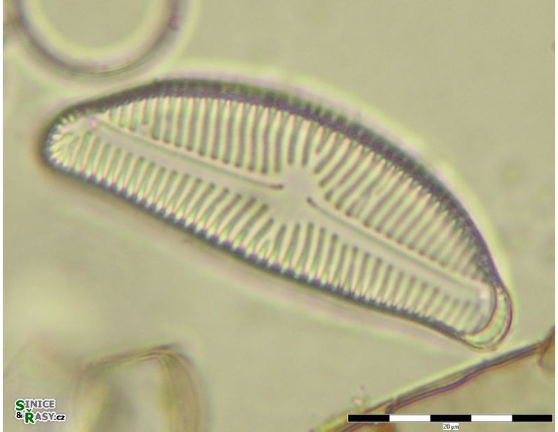Encyonema