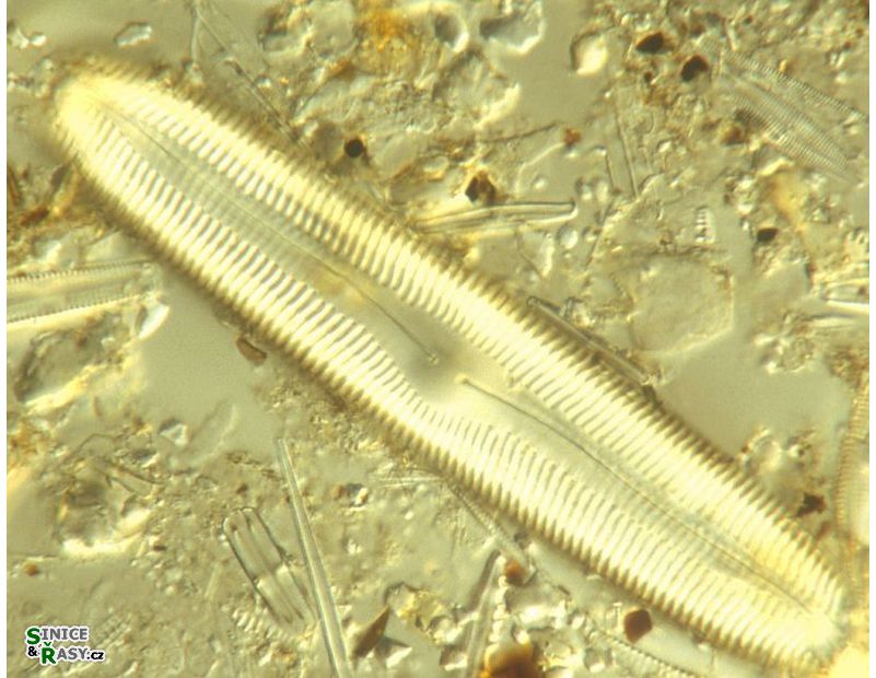 Pinnularia
