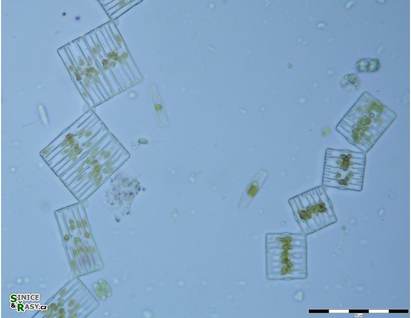 Tabellaria flocculosa