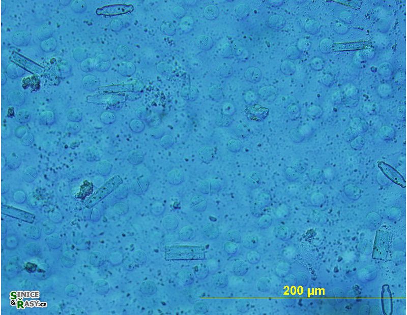 Hydrurus foetidus