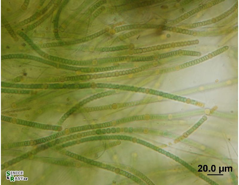 Nodularia harveyana