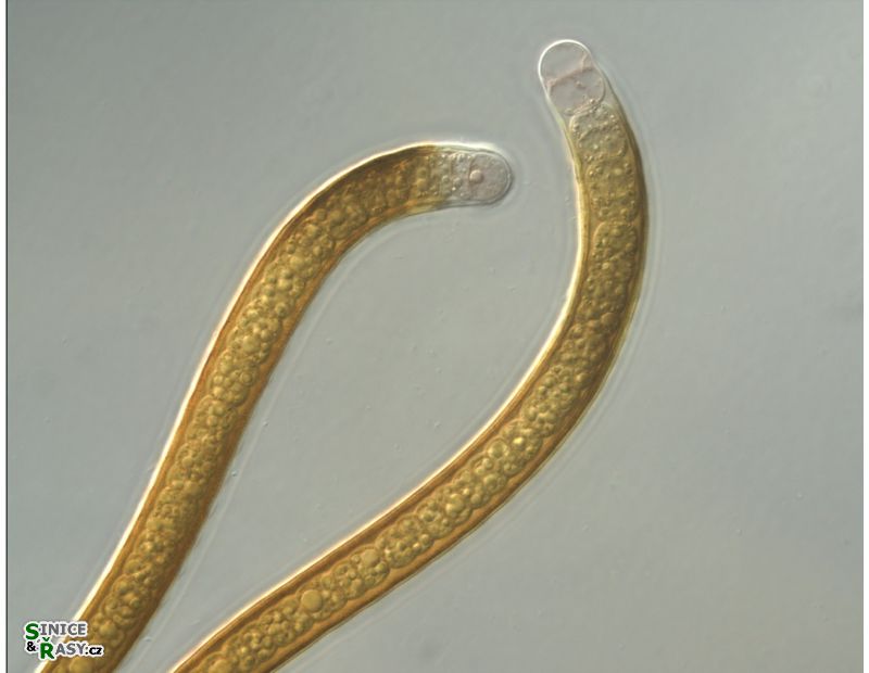 Scytonema sp. 