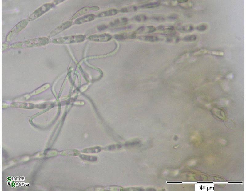 Pseudanabaena starmachii