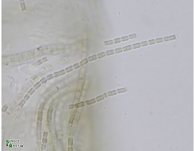 Pseudanabaena sp.