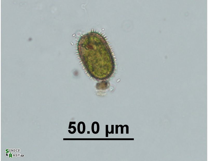 Trachelomonas superba