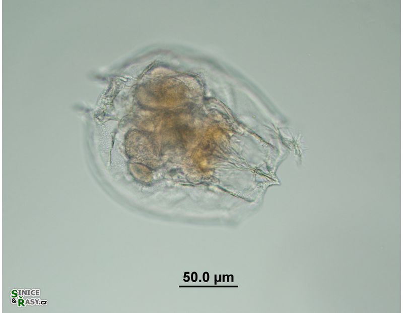 Brachionus angularis