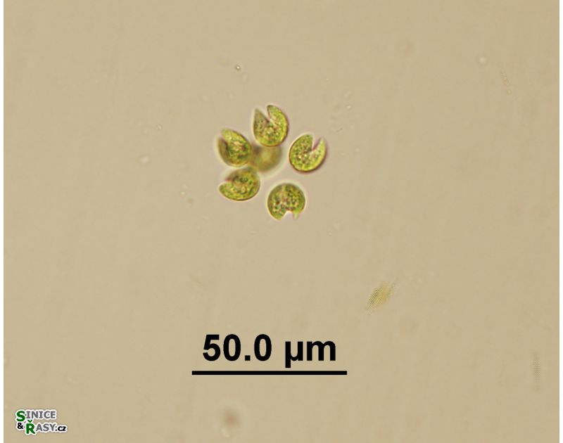 Kirchneriella