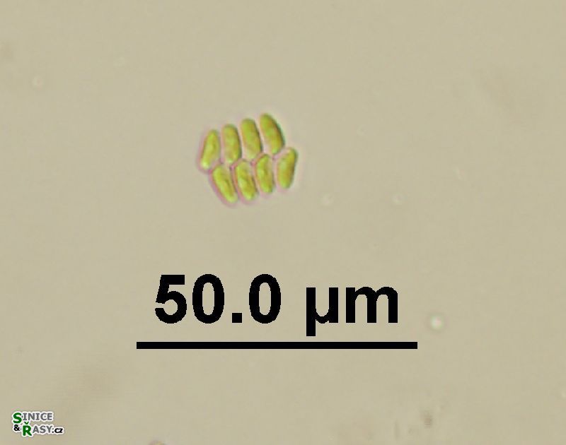Scenedesmus obtusus var. disciformis