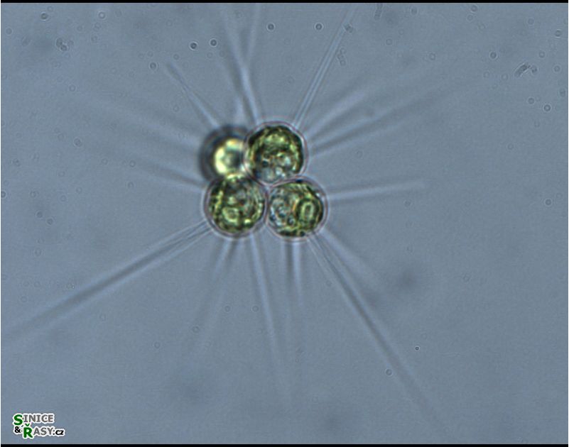 Micractinium bornhemiense
