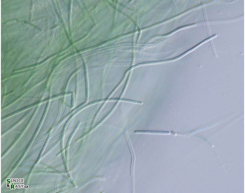 Oculatella