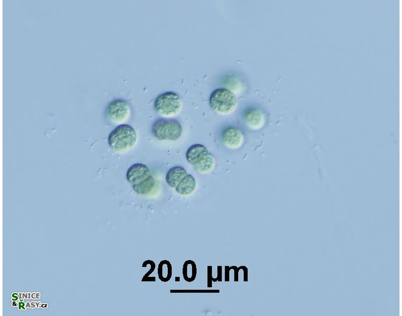 Limnococcus limneticus