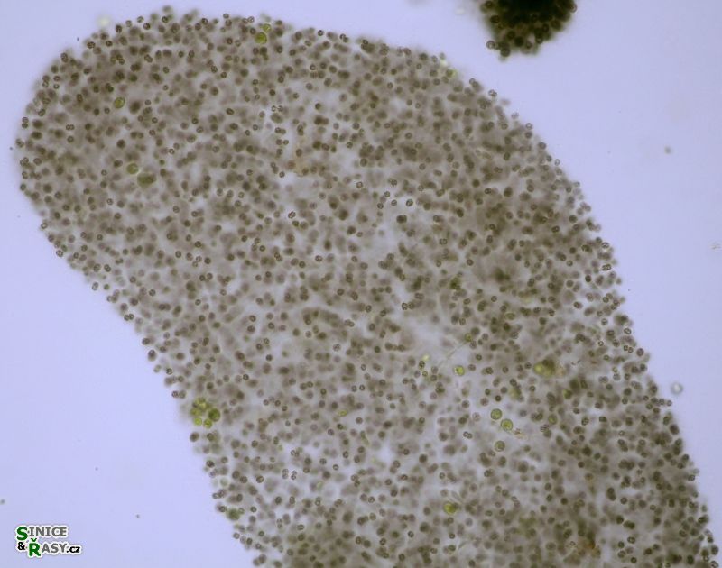 Microcytstis flosaquae