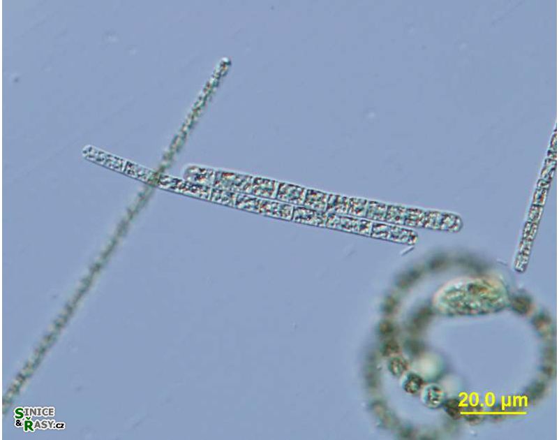 Aphanizomenon flos-aquae