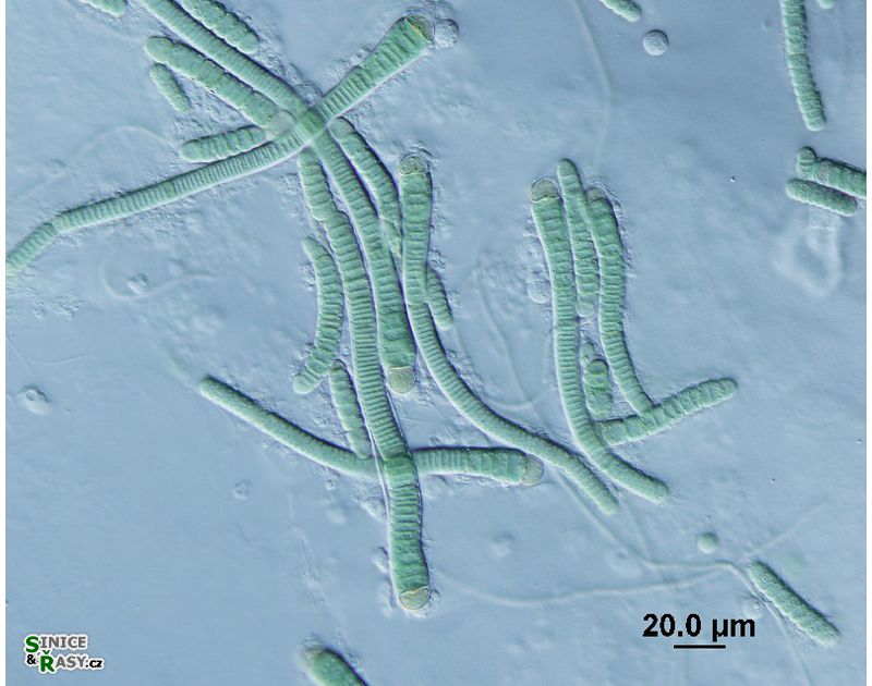 Microchaete sp. 