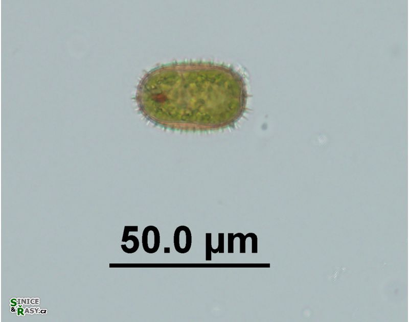 Trachelomonas superba