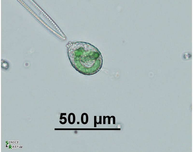 Paulinella chromatophora