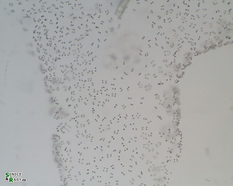 Tetraspora gelatinosa