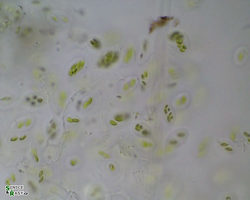 Coccomyxa sp.