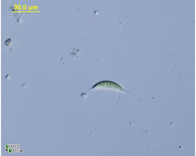 Schroederia