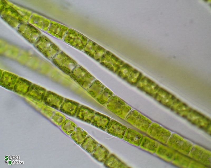 Microspora sp.