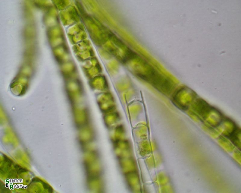 Microspora sp. 