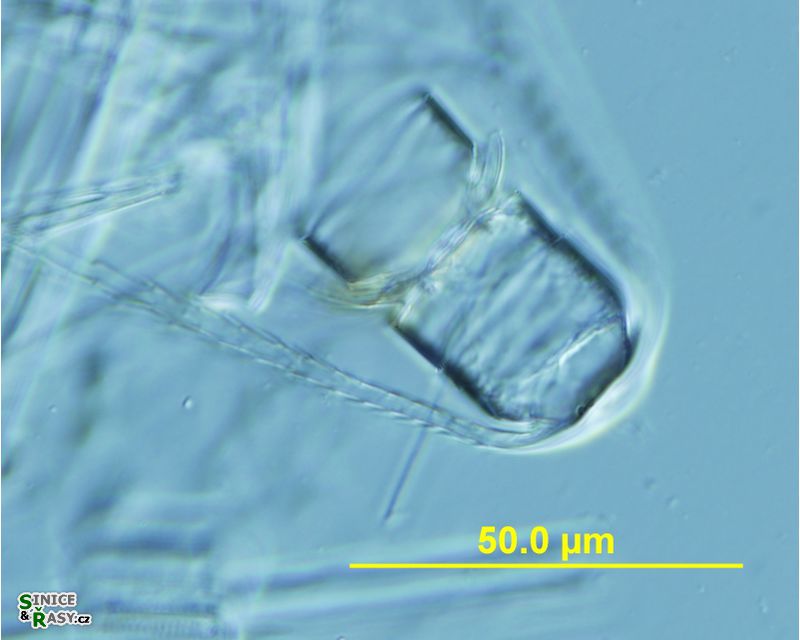 Chaetoceros concavicornis