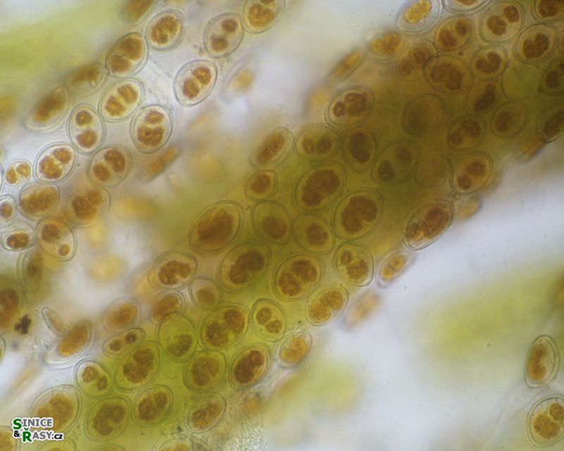 Cocconeis