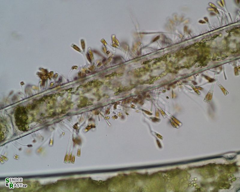 Gomphonema