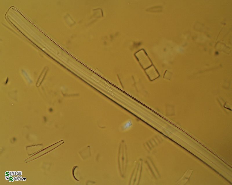 Nitzschia sigmoidea