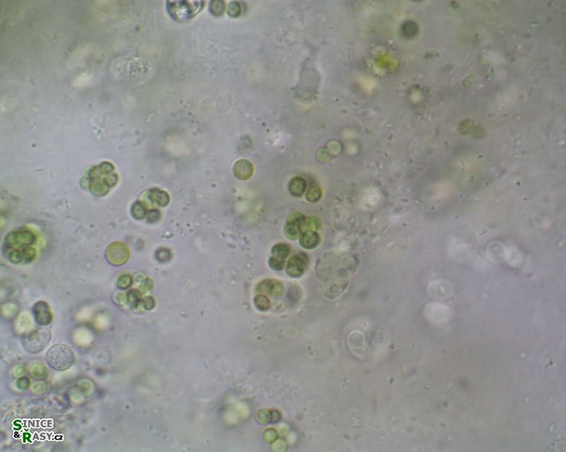 Cyanosarcina