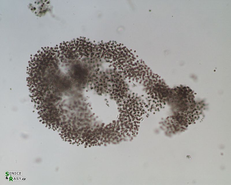 Microcystis aeruginosa