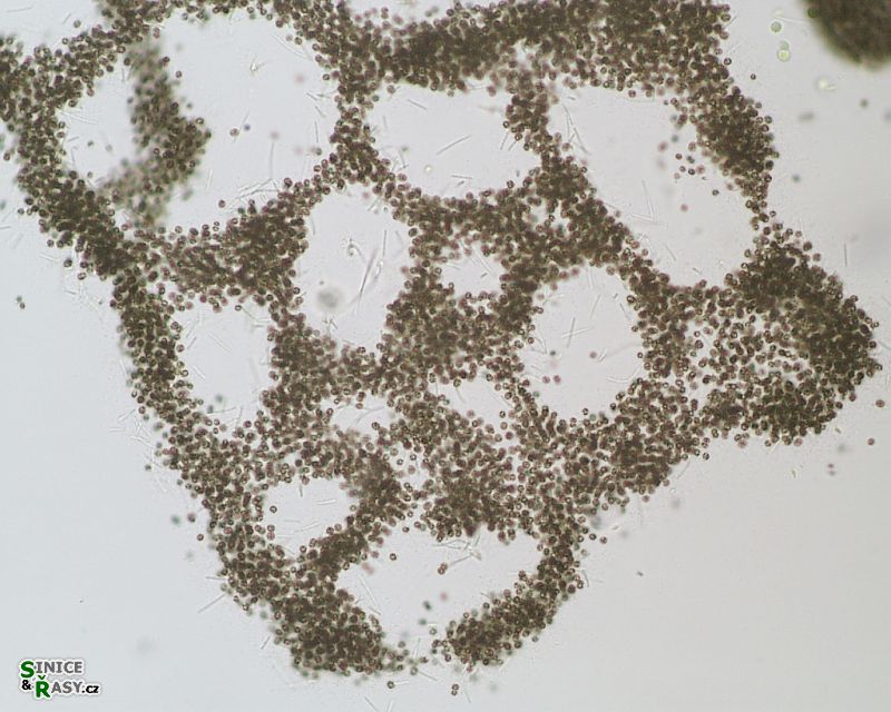 Microcystis aeruginosa