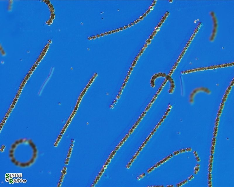 Dolichospermum planctonicum