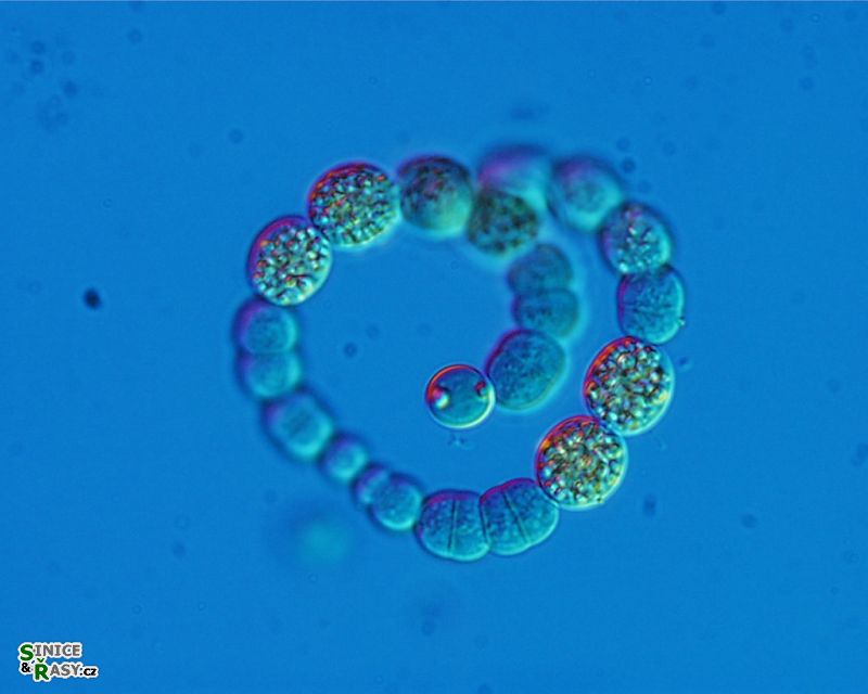 Anabaenopsis