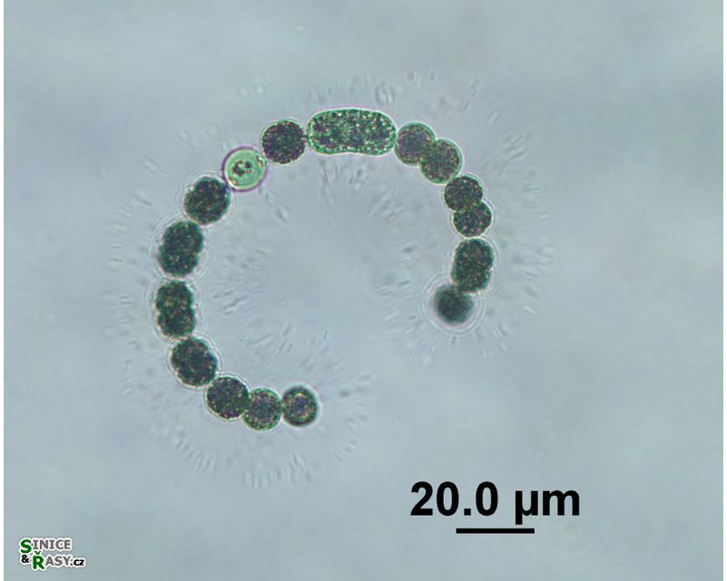 Dolichospermum flos-aquae