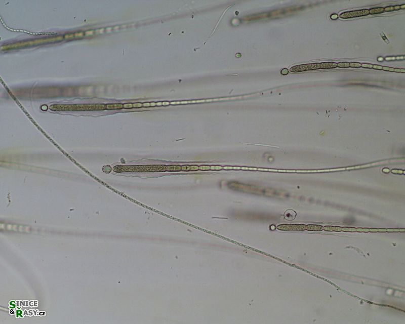 Gloeotrichia sp.